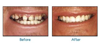 Before and after dental patient pictures